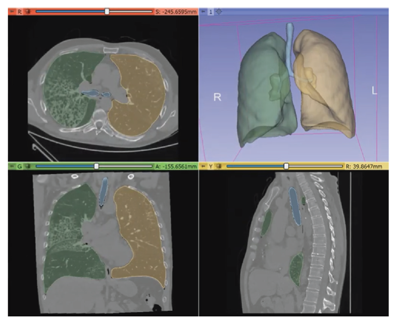 Fig. 2.